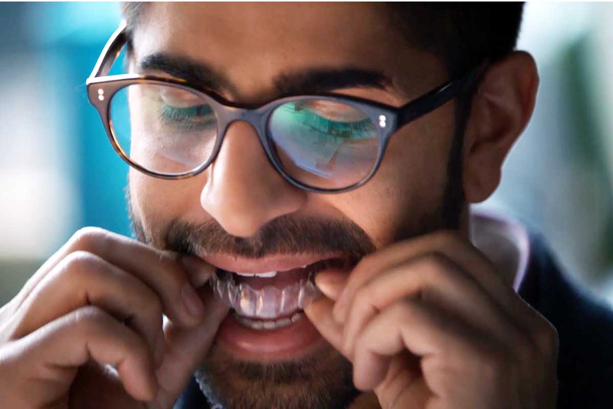 5 Top Benefits of Invisalign Clear Braces