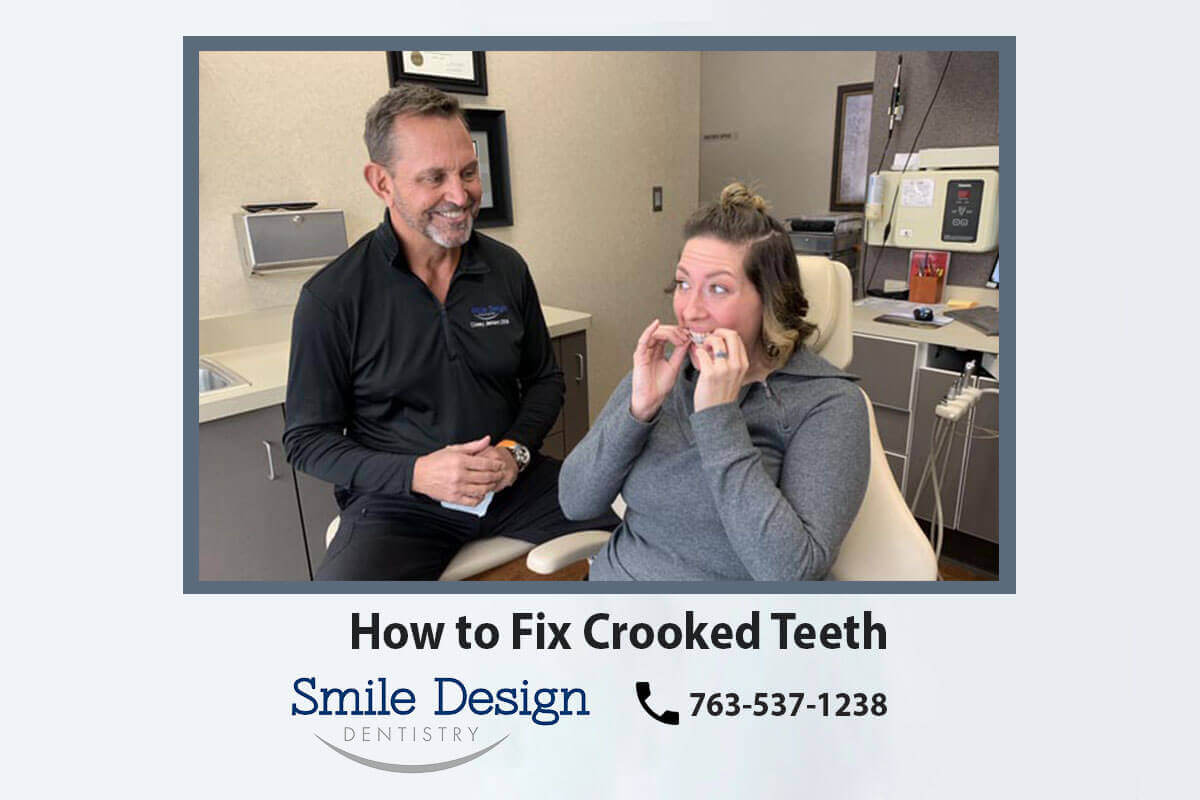 Invisalign Clear Braces are the best option for correcting crooked teeth