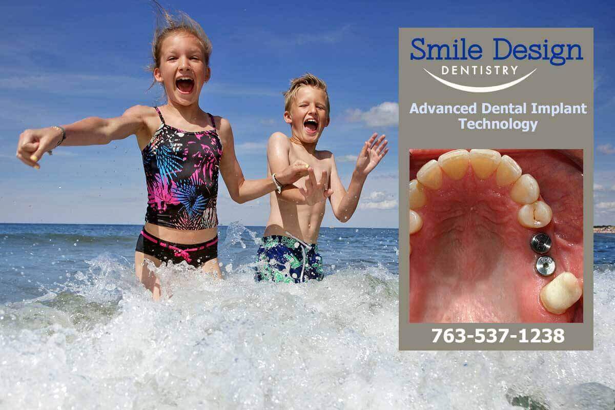 Dental Implants Advanced Technology at Smile Design Dentistry