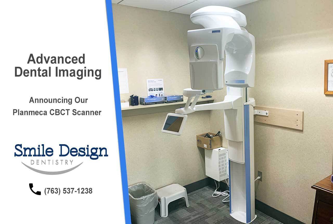 CBCT Scan for Advanced Digital DentistryCBCT Scan for Advanced Digital Dentistry