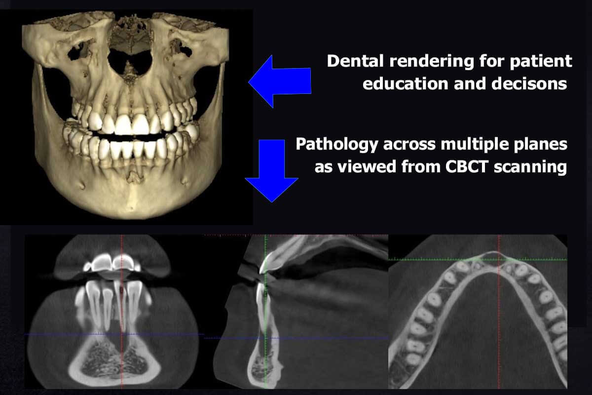 Using CBCT scan for better dental diagnostics