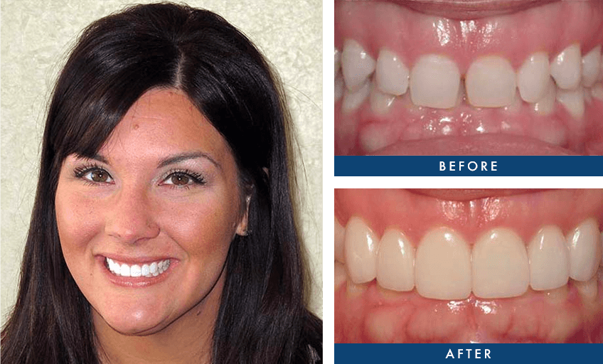 dental before and after