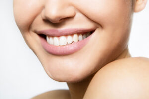 An image of a woman smiling who has a smile makeover.