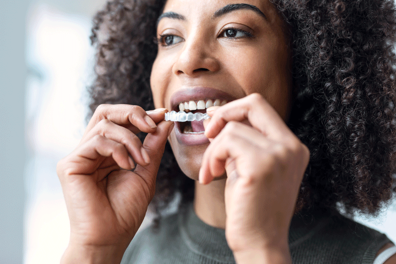 Woman wearing orthodontic silicone trainer. Invisible braces aligner.